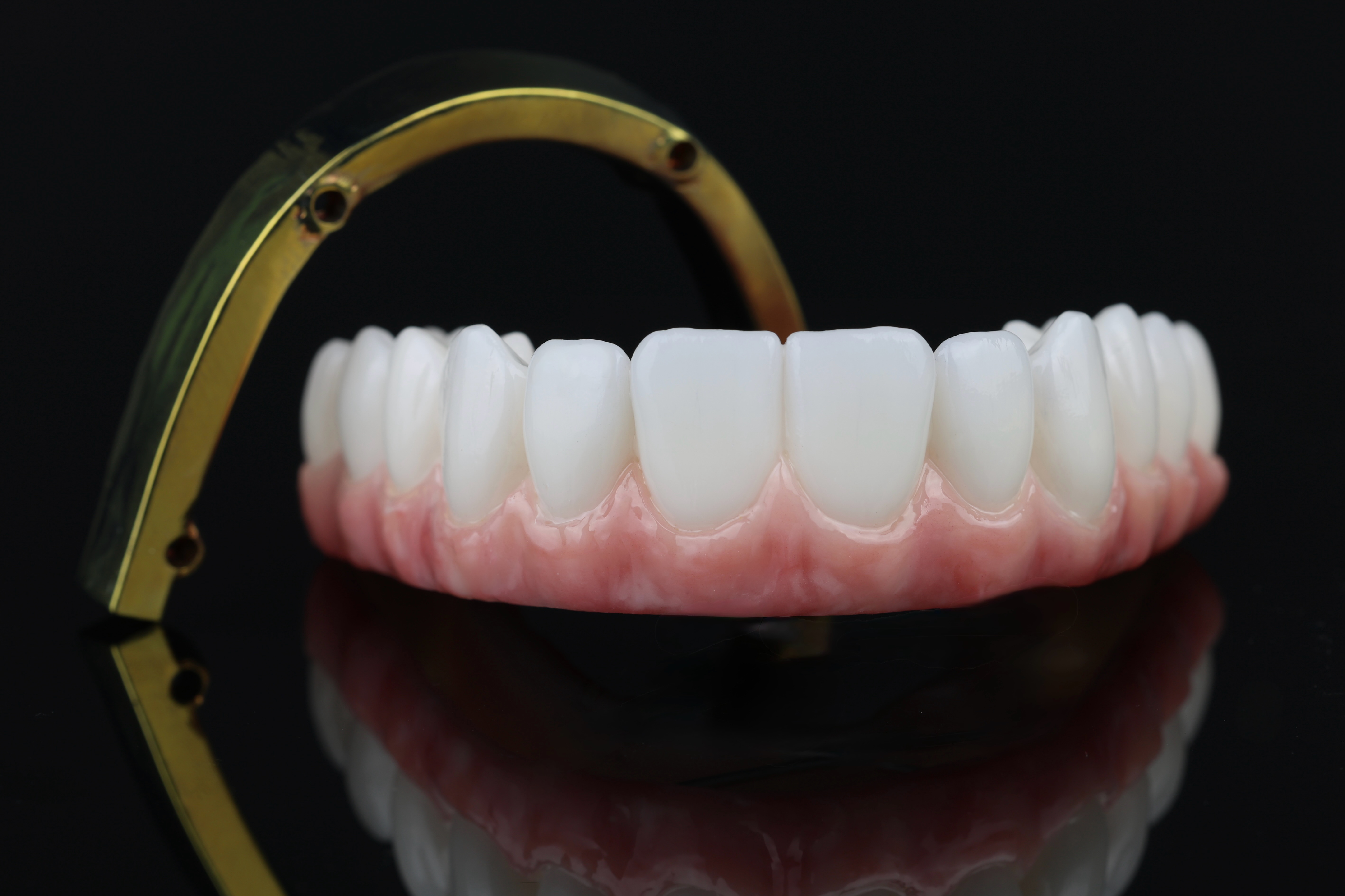 Full zirconia prosthesis with titanium bar — detail