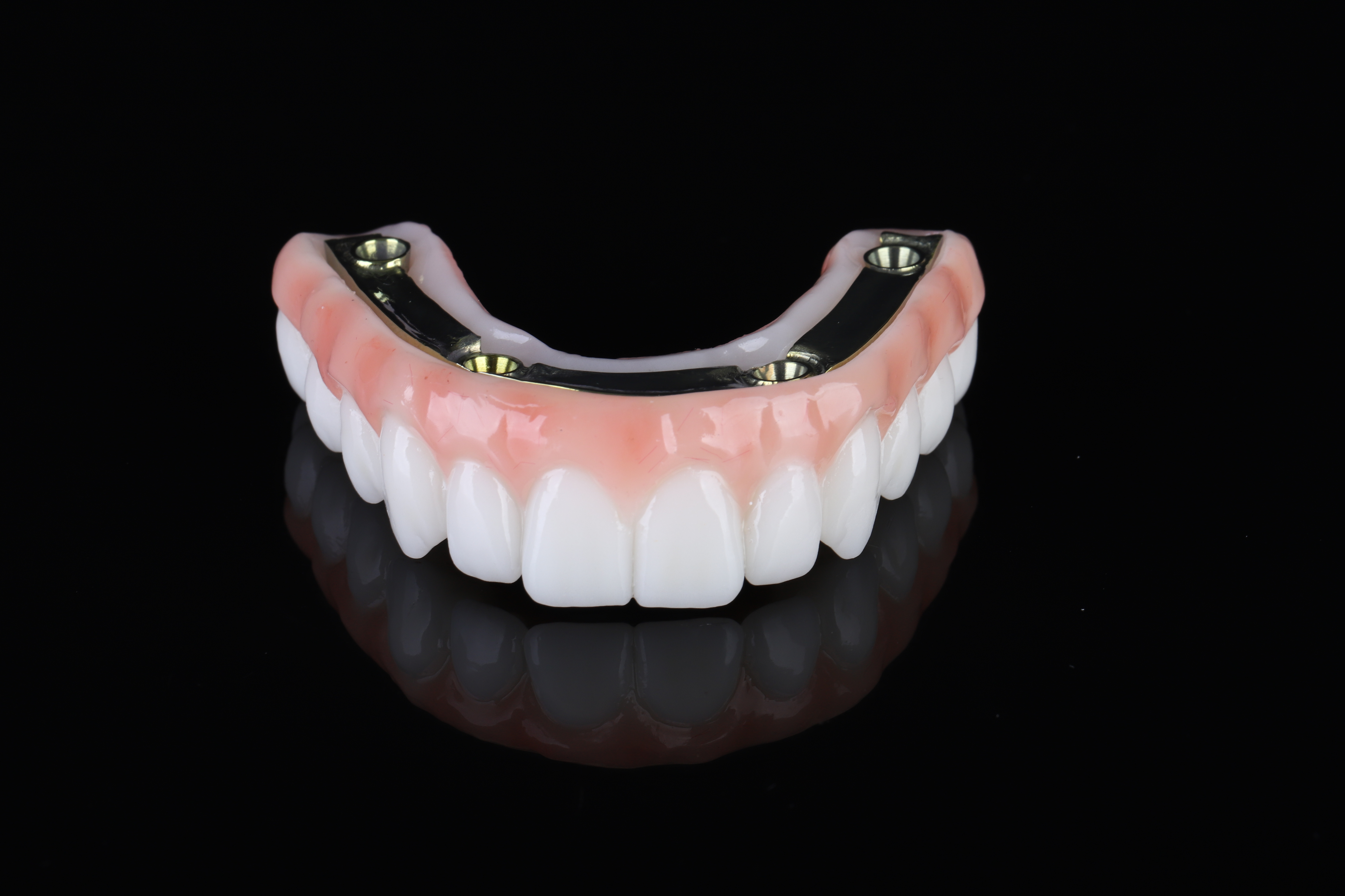 Dental restoration — Epic Dental Creations portfolio