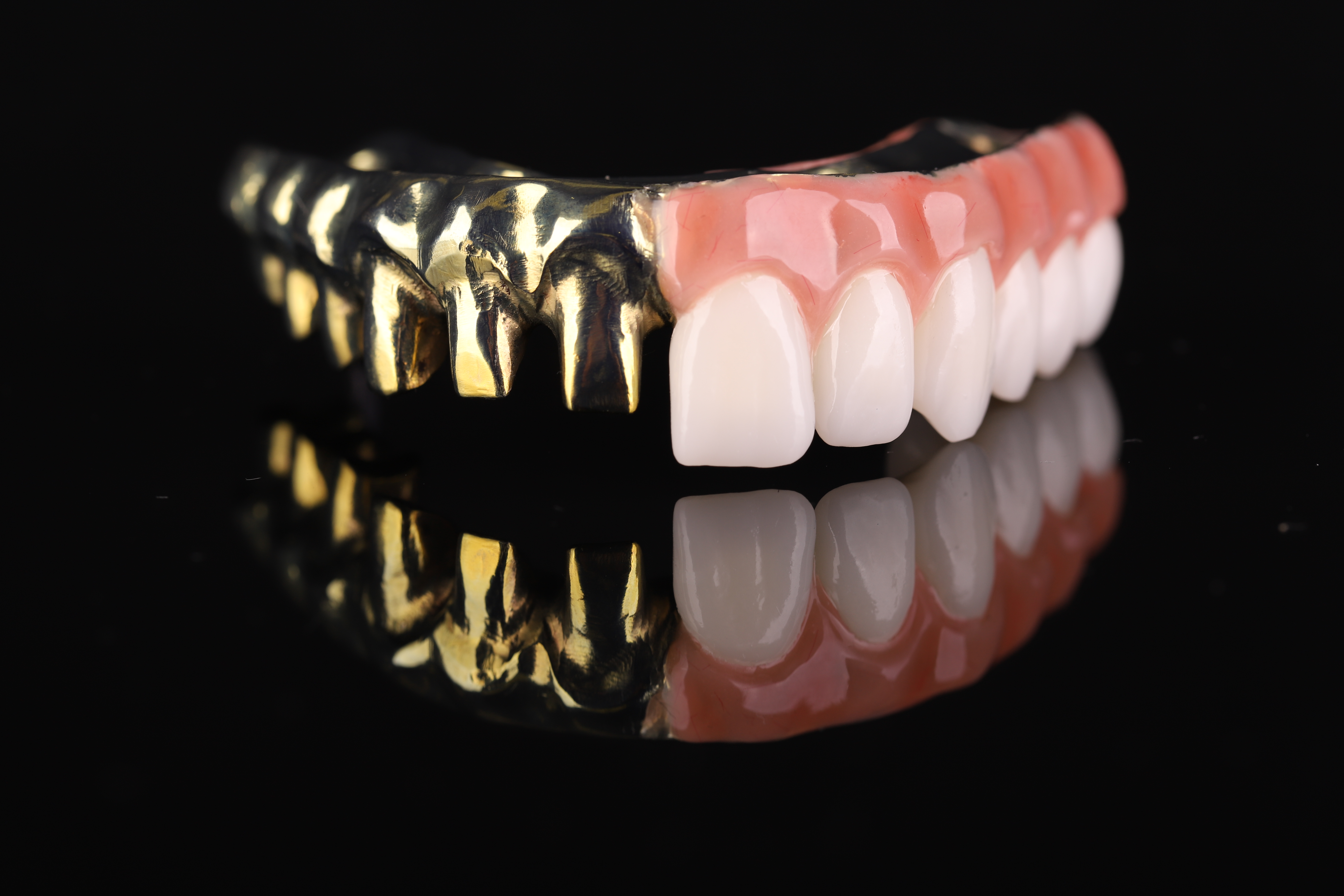Dental restoration — Epic Dental Creations portfolio