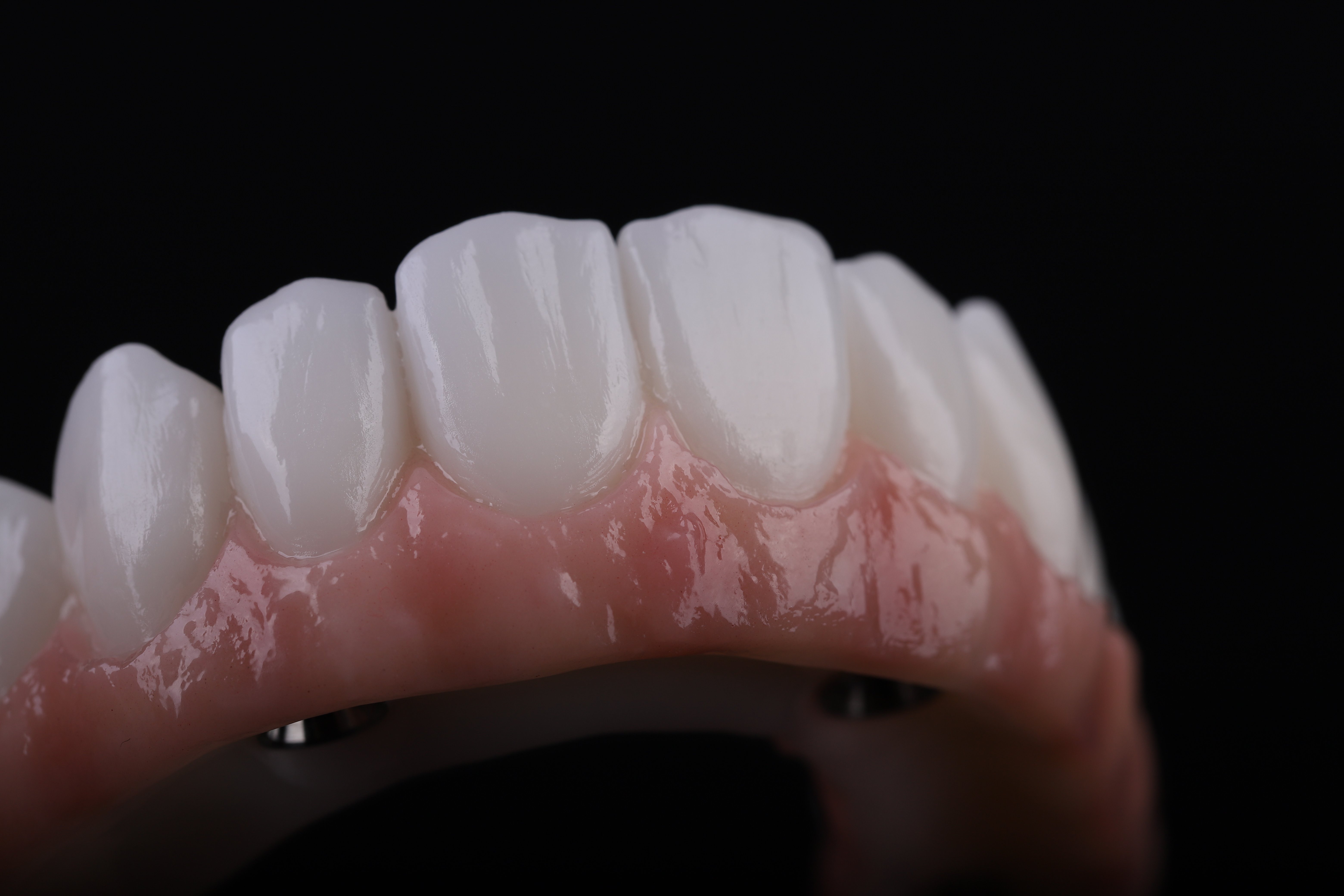Dental restoration — Epic Dental Creations portfolio